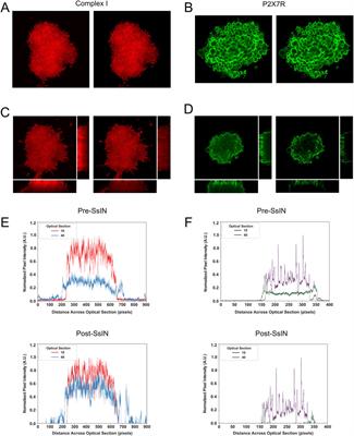 ProDiVis: a method to normalize fluorescence signal localization in 3D specimens
